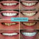 Slider image (10) Dis 212 - Dental Aesthetics Facility